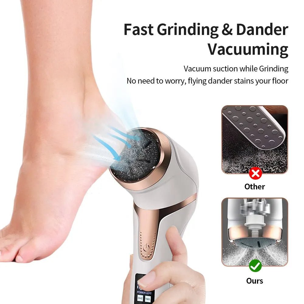 Electric Foot Callus Remover - Zentoracart