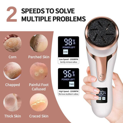 Electric Foot Callus Remover - Zentoracart